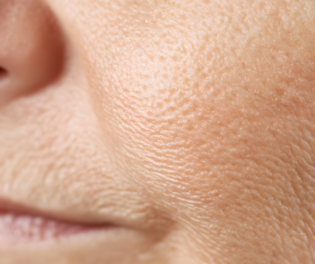 Nahaufnahme von menschlicher Haut mit sichtbaren Poren und feinen Linien.